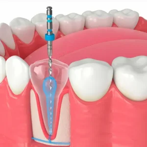 Clínica de Endodoncia 1